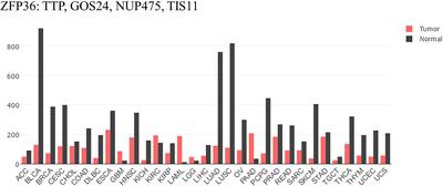 Tristetraprolin, a Potential Safeguard Against Carcinoma: Role in the Tumor Microenvironment